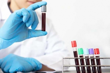 A Simple Blood Test That Can Detect Cancer A Simple Blood Test That Can Detect Cancer