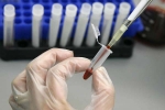 Human Antibodies To Fight Ebola, Ebola Virus, new human antibodies to combat ebola, Sudan virus