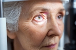 Glaucoma health experts, Glaucoma doctors, all about the eye disease glaucoma, Glaucoma Glaucoma health experts, Glaucoma doctors, all about the eye disease glaucoma, Glaucoma
