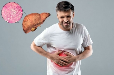 All about Fatty Liver in Non-Drinkers
