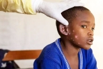Monkeypox Outbreak, Monkeypox, is monkeypox outbreak coming to india, Monkeypox