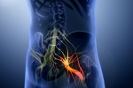 Sciatica, Sciatica nerve disorder, help yourself on sciatica, Pinched nerve