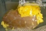 Universal Kidney new updates, Universal Kidney developed, scientists develop universal kidney transplanted to any blood group, Restrictions