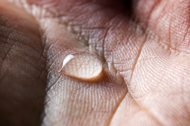 10 Ways To Treat Sweaty Hands And Feet 10 Ways To Treat Sweaty Hands And Feet