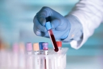 COVID-19, Pittsburg, researchers discover an antibody that can cure covid 19 what is it, Human trials