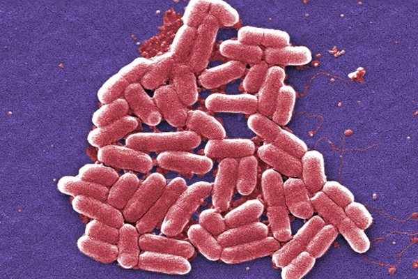 E. coli outbreak, 12 affected in same strain