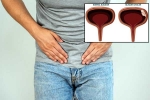 Bladder Cancer in men, Bladder Cancer symptoms, why is bladder cancer common in men, Bladder cancer
