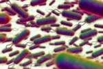 E.coli Outbreak impact, E.coli Outbreak symptoms, all about e coli outbreak in the united kingdom, Scotland