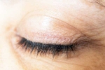 Eyelash Dandruff tips, Eyelash Dandruff news, all about eyelash dandruff, Dry skin