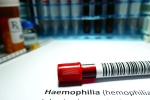 Hemophilia doctors, Hemophilia among men, why are men likely to develop hemophilia, Mutation