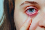 Conjunctivitis in India, Conjunctivitis latest, special measures to prevent conjunctivitis, Pink eye