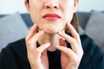 Stress Acne health experts, Acne, does your regular routine cause you acne, Skin care
